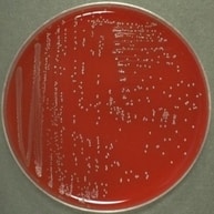 Streptococcus Bovis - Explained Clearly - Made For Medical