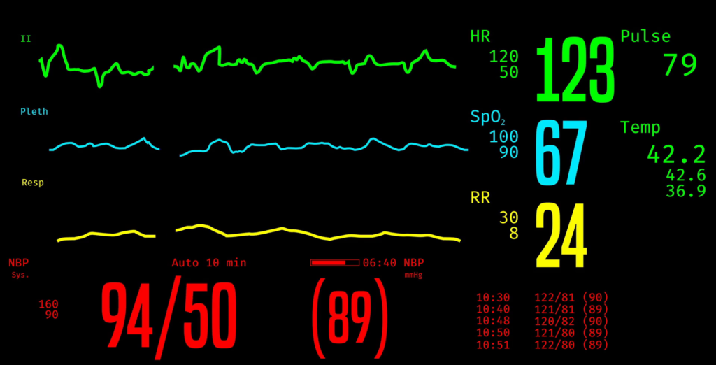 Vital Signs Everything Explained Clearly Made For Medical 9081